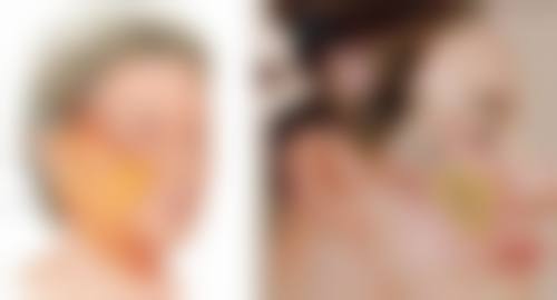 广州军区总医院激光整形美容中 心彭丽霞医生患者评价