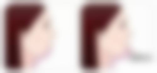 广州军区总医院激光整形美容中 心彭丽霞医生预约挂号指南