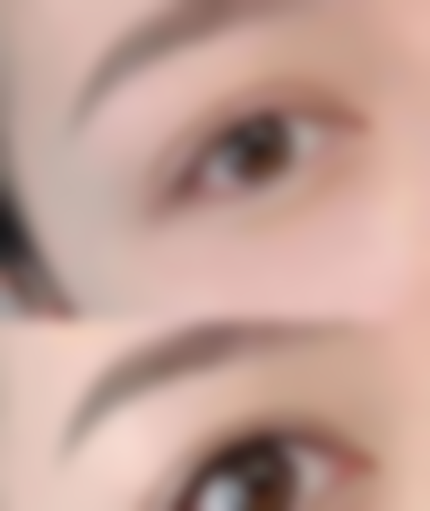 广州军区总医院激光整形美容中 心彭丽霞医生隆鼻技术怎么样？