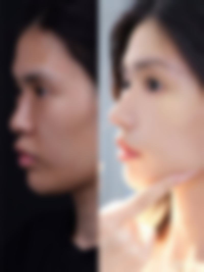 广州壹加壹整形美容医院黄文宜医生擅长项目