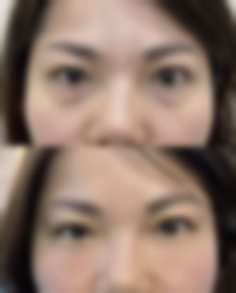 广州壹加壹整形美容医院黄文宜医生吸脂塑身技术怎么样？