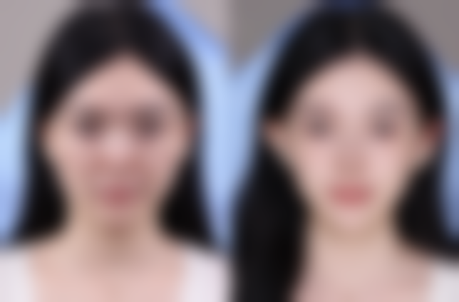 上海郑逸冰医疗美容医院方忠红医生患者评价