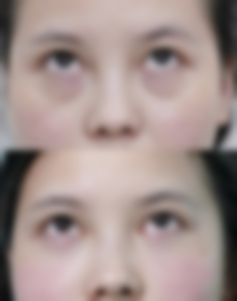 襄阳新艾伊尔整形医院怎么预约