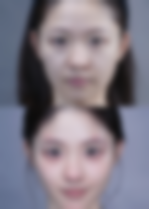 重庆圣熙整形医院怎么预约