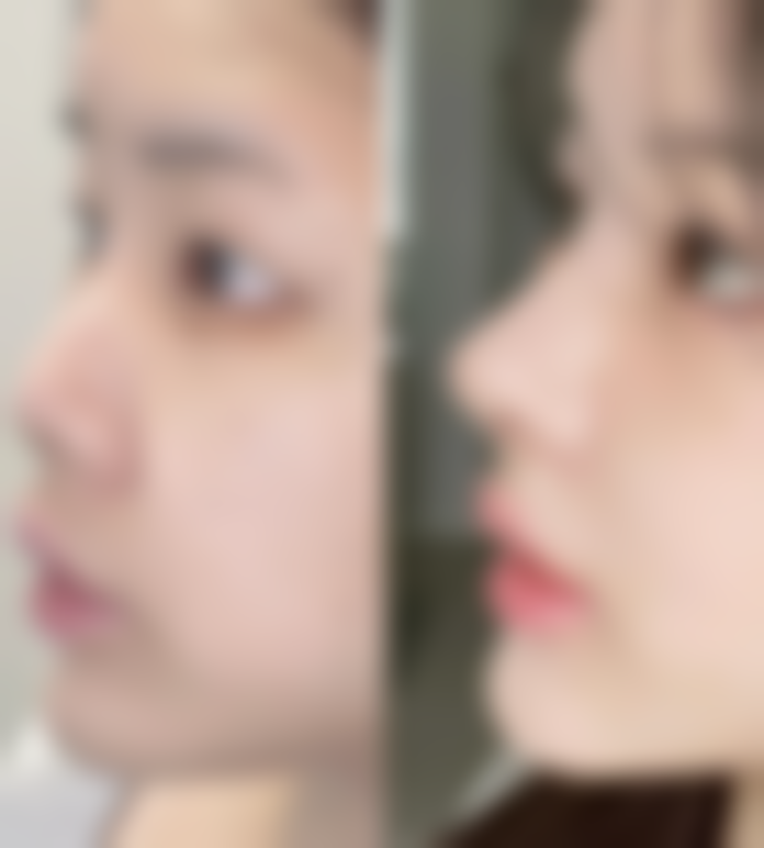 广州壹加壹整形美容医院姚文波医生患者评价