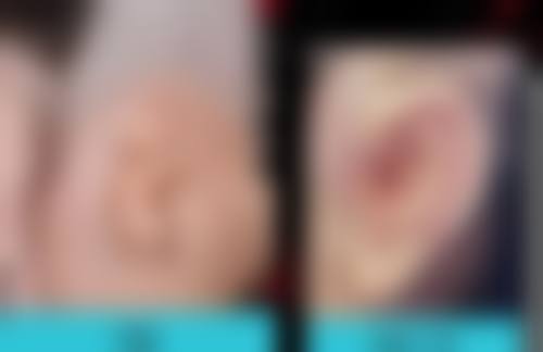 注射与填充治疗适用于哪些情况？