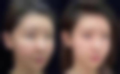 其他物理治疗有哪些？