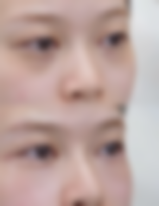 龙游盛熙妍整形医院怎么预约