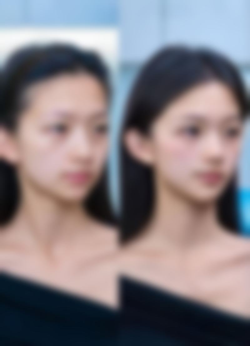 国内有哪些推荐的去眼袋医生？