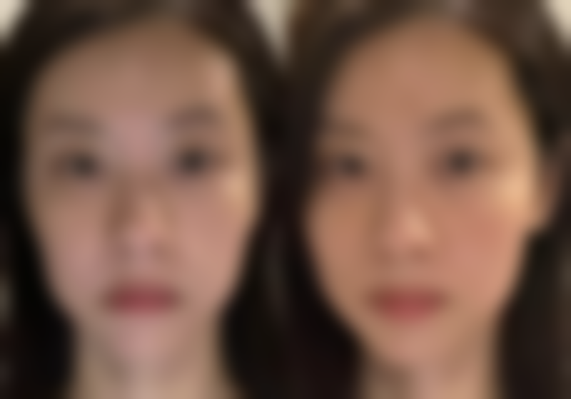 饮食与运动对祛除黑眼圈和眼袋有帮助吗？