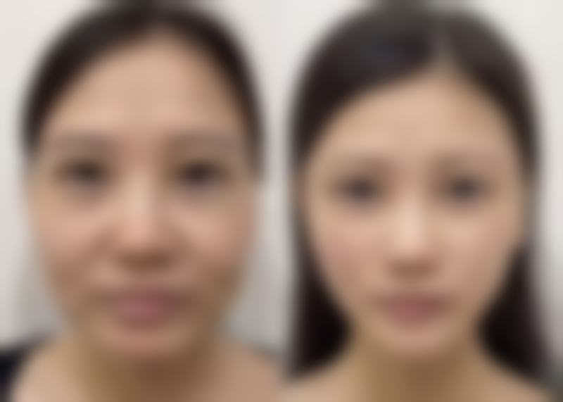 广州军区总医院激光整形美容中 心彭丽霞医生预约挂号指南