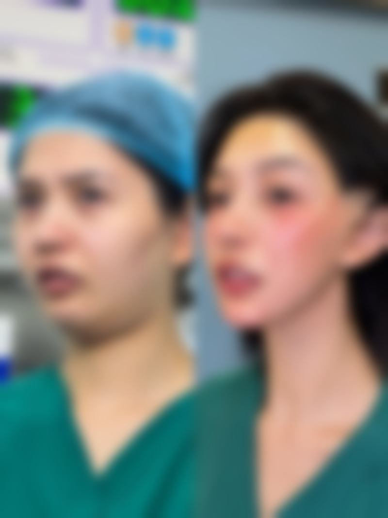 活细胞/自体细胞隆鼻的成效怎么样呢?