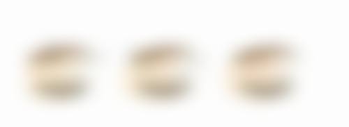 手术治疗疤痕疙瘩有哪些方式，各有什么优缺点？