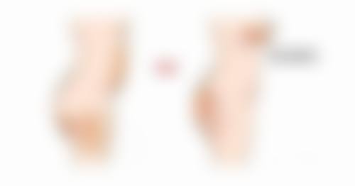 植发密度与哪些因素有关呢？