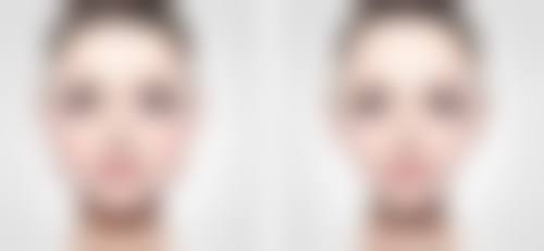 延吉一妍整形医院收费价格表