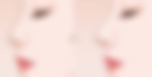 疤痕疙瘩应该怎么治？手术、药物、激光，哪种方法治疗效果好又安全呢？ 