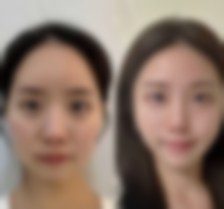 运城薇莱美整形医院正规吗？