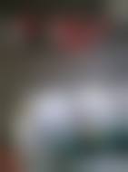 长春朝阳麦西美嘉医疗美容诊所赵雯医生韩式植眉技术怎么样？