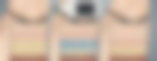 CRT自体胶原蛋白再生丰胸术的原理和额外应用有哪些？