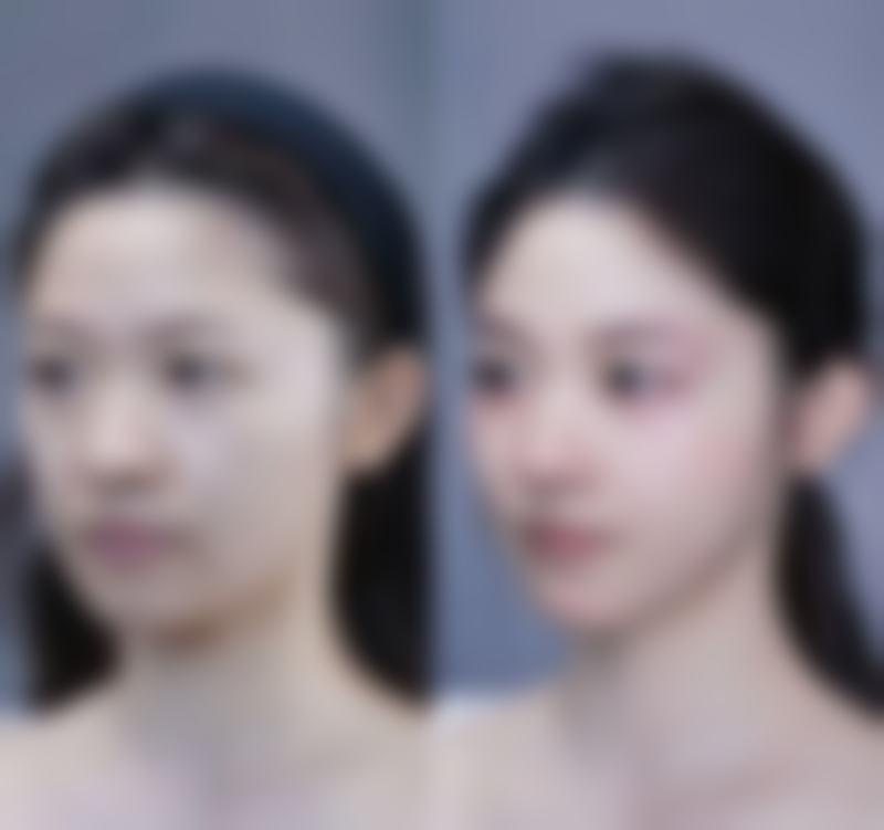 厦门174医院整形美容科米增法医生患者评价