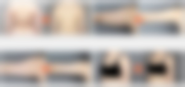 韩国365mc吸脂医院金大谦（大田院）医生患者评价：