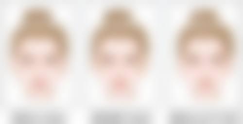 治疗面部凹陷疤痕后该怎么护理？