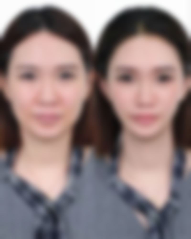 上海嘉会整形医疗诊所（静安）楼晓莉医生预约挂号指南