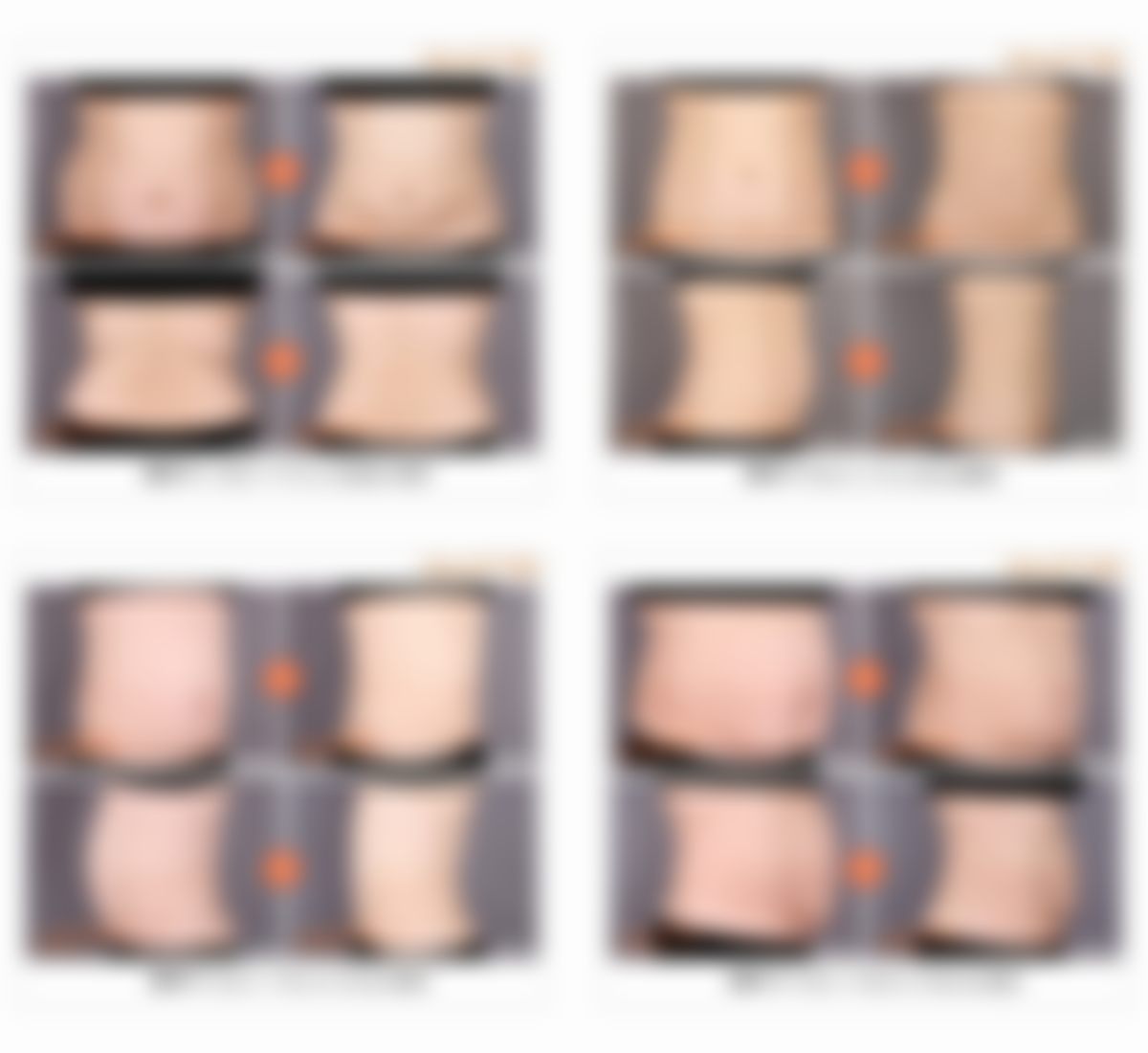 韩国365mc吸脂医院李在濬(兰斯特别中 心院长)医生收费价格