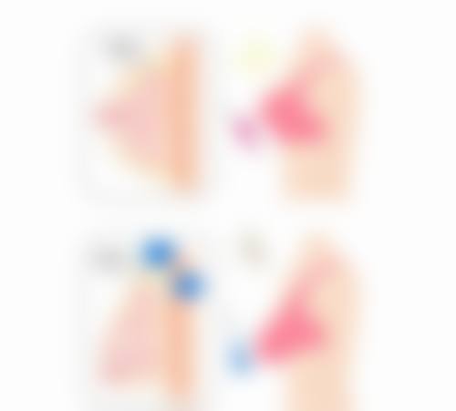 BY整形外科蔡秀旭医生擅长项目