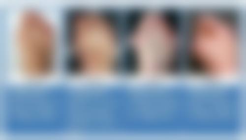 BY整形外科蔡秀旭医生隆鼻失败修复技术怎么样？