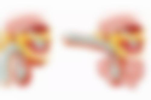 趴床时需要什么姿势辅助？