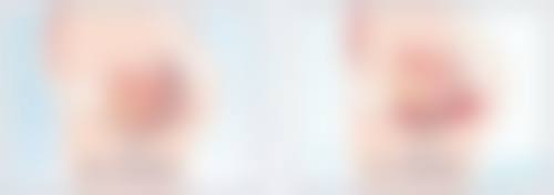 郴州市美科医疗美容医院尹伟力医生患者评价