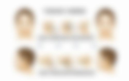 不同假体类型的趴床要求有什么不同？