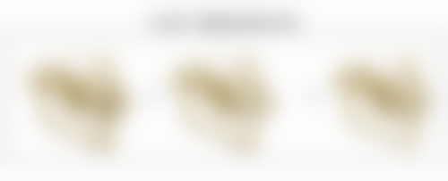 水动力吸脂多久能恢复？这与个人体质、吸脂部位和术后护理等因素密切相关 