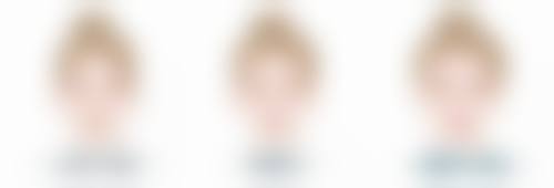 不同部位的水动力吸脂修复时间一样吗？