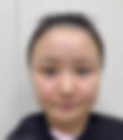 郑州张朝蕾医疗美容医院口碑评价怎么样?