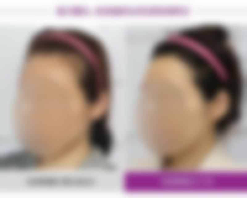 BY整形外科蔡秀旭医生患者评价