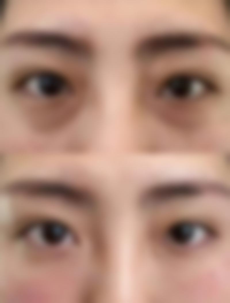 武汉协和医院整形美容中 心柳向东医生患者评价