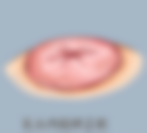 乐提葆在瘦脸针牌子中表现如何？