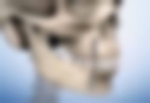 选择瘦脸针牌子时需要考虑哪些因素呢？