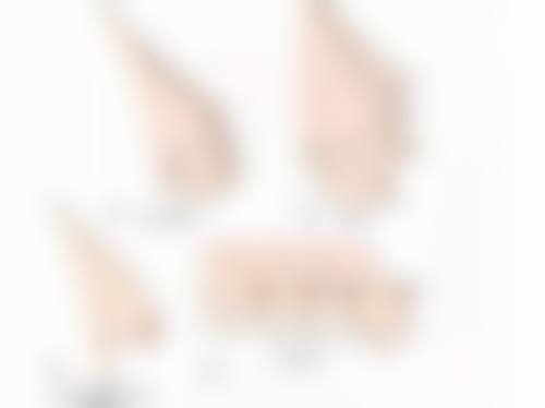 激光去眼袋有什么局限性？