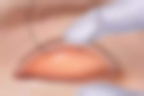 总结
