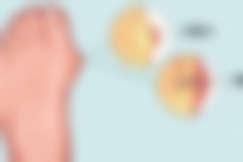 Botox瘦脸针多久能见效？