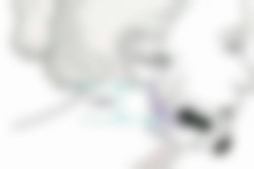 Botox瘦脸针有什么核心优势？