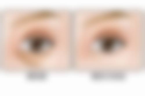 郴州市美科医疗美容医院李单霞医生预约挂号指南