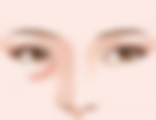 常规愈合良好无并发症的情况下，提眉眼袋术后多久可以洗澡？