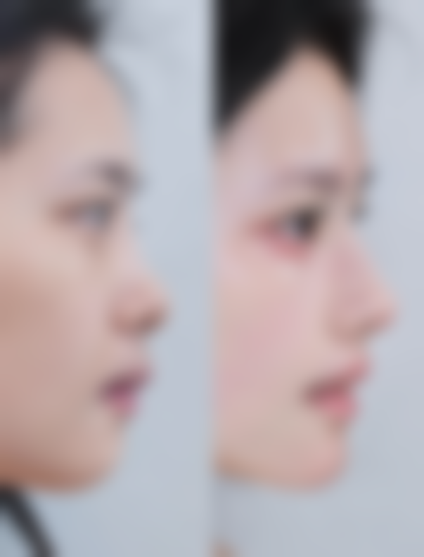 郴州市美科医疗美容医院李单霞医生擅长项目