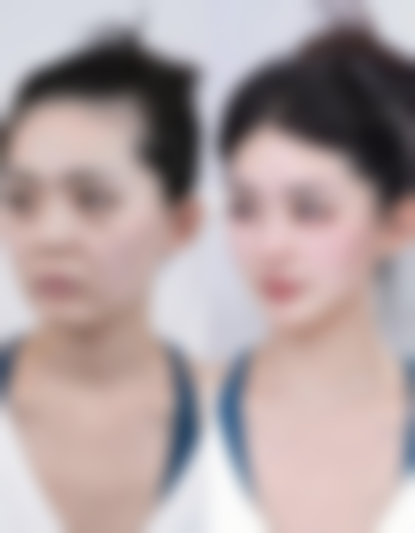 郴州市美科医疗美容医院李单霞医生激光脱毛技术怎么样？