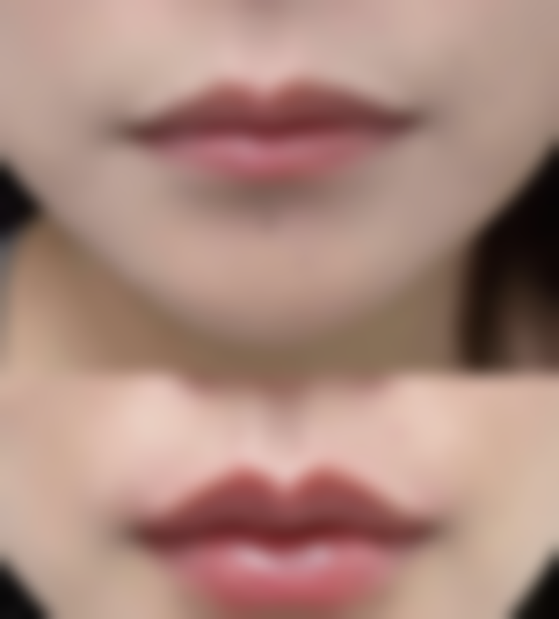 提眉眼袋术后多久可以洗澡？一般术后7 - 10天伤口愈合后，就能放心洗澡啦！ 