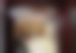 北京京城皮肤病医院乔雅登极致0.8ML技术优势有哪些？